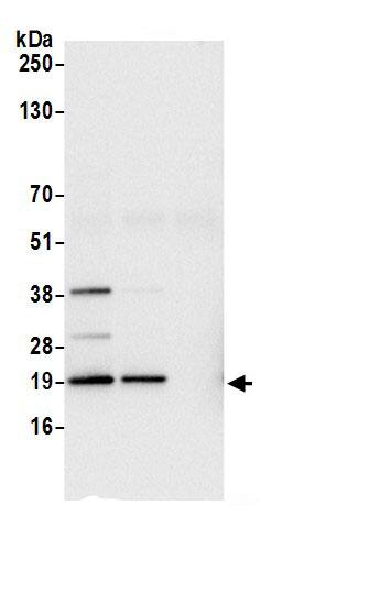 Immunoprecipitation:RPL27A AntibodyNBP3-29633] -Detection of human RPL27A by western blot of immunoprecipitates. Samples: Whole cell lysate (0.5 or 1.0 mg per IP reaction; 20% of IP loaded) from HeLa cells prepared using NETN lysis buffer. Antibodies: Affinity purified rabbit anti-RPL27A antibody NBP3-29633 (lot NBP3-29633-1) used for IP at 6 µg per reaction. RPL27A was also immunoprecipitated by rabbit anti-RPL27A antibody BL21345. For blotting immunoprecipitated RPL27A, NBP3-29633 was used at 1 µg/ml. Detection: Chemiluminescence with an exposure time of 1 second.