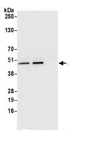 Immunoprecipitation:UQCRC2 AntibodyNBP3-29635] -Detection of human UQCRC2 by western blot of immunoprecipitates. Samples: Whole cell lysate (0.5 or 1.0 mg per IP reaction; 20% of IP loaded) from 293T cells prepared using NETN lysis buffer. Antibodies: Affinity purified rabbit anti-UQCRC2 antibody NBP3-29635 (lot NBP3-29635-1) used for IP at 6 µg per reaction. UQCRC2 was also immunoprecipitated by rabbit anti-UQCRC2 antibody BL21405. For blotting immunoprecipitated UQCRC2, NBP3-29635 was used at 1 µg/ml. Detection: Chemiluminescence with an exposure time of 3 seconds.