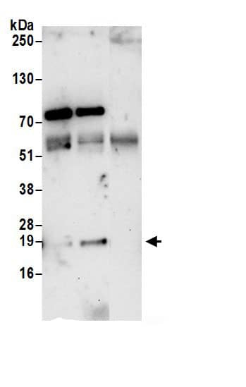 Immunoprecipitation:ARPC3 AntibodyNBP3-29636] -Detection of human ARPC3 by western blot of immunoprecipitates. Samples: Whole cell lysate (0.5 or 1.0 mg per IP reaction; 20% of IP loaded) from Jurkat cells prepared using NETN lysis buffer. Antibodies: Affinity purified rabbit anti-ARPC3 antibody NBP3-29636 (lot NBP3-29636-1) used for IP at 6 µg per reaction. ARPC3 was also immunoprecipitated by rabbit anti-ARPC3 antibody BL21431. For blotting immunoprecipitated ARPC3, NBP3-29636 was used at 1 µg/ml. Detection: Chemiluminescence with an exposure time of 30 seconds.