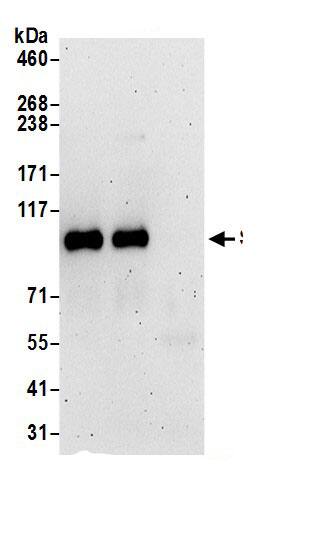 Immunoprecipitation:STIM2 AntibodyNBP3-29638] -Detection of human STIM2 by western blot of immunoprecipitates. Samples: Whole cell lysate (1 mg for IP; 20% of IP loaded) prepared using NETN buffer from HeLa cells. Antibodies: Affinity purified rabbit anti-STIM2 antibody NBP3-29638 (lot NBP3-29638-1) used for IP at 6 µg per reaction. STIM2 was also immunoprecipitated by rabbit anti-STIM2.. For blotting immunoprecipitated STIM2, was used at 1 µg/ml. Detection: Chemiluminescence with an exposure time of 3 minutes.