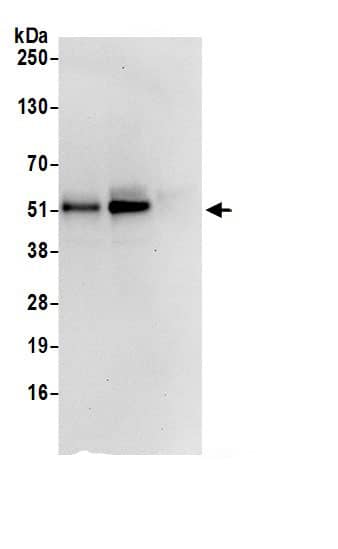 Immunoprecipitation:SNX8 AntibodyNBP3-29640] -Detection of human SNX8 by western blot of immunoprecipitates. Samples: Whole cell lysate (0.5 or 1.0 mg per IP reaction; 20% of IP loaded) from Jurkat cells prepared using NETN lysis buffer. Antibodies: Affinity purified rabbit anti-SNX8 antibody NBP3-29640 (lot NBP3-29640-1) used for IP at 6 µg per reaction. SNX8 was also immunoprecipitated by rabbit anti-SNX8 antibody BL19385. For blotting immunoprecipitated SNX8, NBP3-29640 was used at 1 µg/ml. Detection: Chemiluminescence with an exposure time of 10 seconds.
