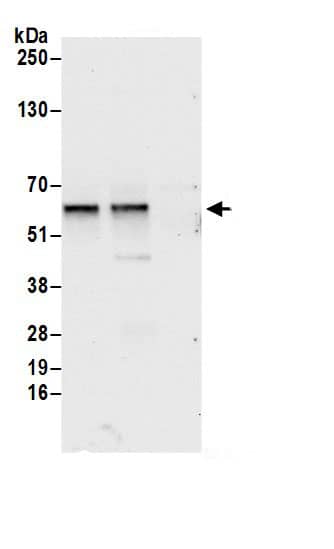 Immunoprecipitation:dynactin 4 AntibodyNBP3-29641] -Detection of human DCTN4 by western blot of immunoprecipitates. Samples: Whole cell lysate (0.5 or 1.0 mg per IP reaction; 20% of IP loaded) from HeLa cells prepared using NETN lysis buffer. Antibodies: Affinity purified rabbit anti-DCTN4 antibody NBP3-29641 (lot NBP3-29641-1) used for IP at 6 µg per reaction. DCTN4 was also immunoprecipitated by rabbit anti-DCTN4 antibody BL19260. For blotting immunoprecipitated DCTN4, NBP3-29641 was used at 1 µg/ml. Detection: Chemiluminescence with an exposure time of 10 seconds.