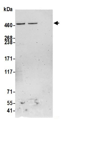Immunoprecipitation:SACS AntibodyNBP3-29646] -Detection of human SACS by western blot of immunoprecipitates. Samples: Whole cell lysate (0.5 or 1.0 mg per IP reaction; 20% of IP loaded) from Jurkat cells prepared using NETN lysis buffer. Antibodies: Affinity purified rabbit anti-SACS antibody NBP3-29646 (lot NBP3-29646-1) used for IP at 6 µg per reaction. SACS was also immunoprecipitated by rabbit anti-SACS.. For blotting immunoprecipitated SACS, NBP3-29646 was used at 1 µg/ml. Detection: Chemiluminescence with an exposure time of 3 minutes.