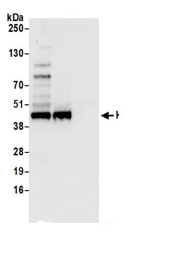 Immunoprecipitation:Cyclophilin 40 AntibodyNBP3-29647] -Detection of human PPID by western blot of immunoprecipitates. Samples: Whole cell lysate (0.5 or 1.0 mg per IP reaction; 20% of IP loaded) from 293T cells prepared using NETN lysis buffer. Antibodies: Affinity purified rabbit anti-PPID antibody NBP3-29647 (lot NBP3-29647-1) used for IP at 6 µg per reaction. PPID was also immunoprecipitated by rabbit anti-PPID.. For blotting immunoprecipitated PPID, NBP3-29647 was used at 0.4 µg/ml. Detection: Chemiluminescence with an exposure time of 3 seconds.