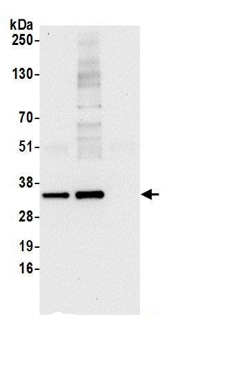 Immunoprecipitation:ARPC2 AntibodyNBP3-29648] -Detection of human ARPC2 by western blot of immunoprecipitates. Samples: Whole cell lysate (0.5 or 1.0 mg per IP reaction; 20% of IP loaded) from 293T cells prepared using NETN lysis buffer. Antibodies: Affinity purified rabbit anti-ARPC2 antibody NBP3-29648 (lot NBP3-29648-1) used for IP at 6 µg per reaction. ARPC2 was also immunoprecipitated by rabbit anti-ARPC2 antibody BL21244. For blotting immunoprecipitated ARPC2, NBP3-29648 was used at 0.4 µg/ml. Detection: Chemiluminescence with an exposure time of 10 seconds.