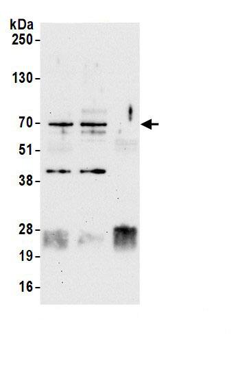 Immunoprecipitation:CBX4 AntibodyNBP3-29650] -Detection of human Pc2 by western blot of immunoprecipitates. Samples: Whole cell lysate (1.0 mg per IP reaction; 20% of IP loaded) from HeLa cells prepared using NETN lysis buffer. Antibodies: Affinity purified rabbit anti-Pc2 antibody (NBP3-29650 lot 2) used for IP at 6 µg per reaction. Pc2 was also immunoprecipitated by a previous lot of this antibody (NBP3-29650 lot 1). For blotting immunoprecipitated Pc2, NBP3-29650 was used at 0.1 µg/ml. Detection: Chemiluminescence with an exposure time of 30 seconds.