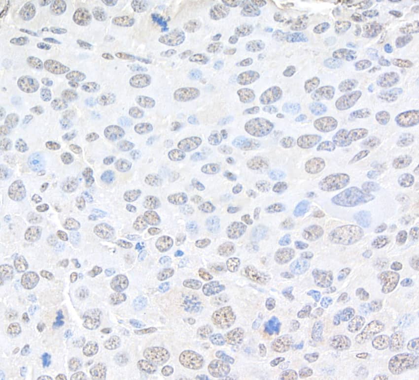 Immunohistochemistry CBX4 Antibody