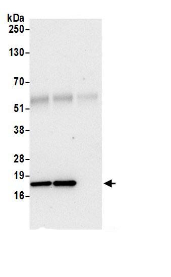 Immunoprecipitation:NDUFB6 AntibodyNBP3-29652] -Detection of human NDUFB6 by western blot of immunoprecipitates. Samples: Whole cell lysate (0.5 or 1.0 mg per IP reaction; 20% of IP loaded) from 293T cells prepared using NETN lysis buffer. Antibodies: Affinity purified rabbit anti-NDUFB6 antibody NBP3-29652 (lot NBP3-29652-1) used for IP at 6 µg per reaction. NDUFB6 was also immunoprecipitated by rabbit anti-NDUFB6.. For blotting immunoprecipitated NDUFB6, NBP3-29652 was used at 1 µg/ml. Detection: Chemiluminescence with an exposure time of 10 seconds.