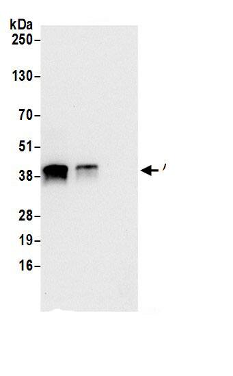 Immunoprecipitation:ASNA1 AntibodyNBP3-29654] -Detection of human ASNA1 by western blot of immunoprecipitates. Samples: Whole cell lysate (0.5 or 1.0 mg per IP reaction; 20% of IP loaded) from 293T cells prepared using NETN lysis buffer. Antibodies: Affinity purified rabbit anti-ASNA1 antibody NBP3-29654 (lot NBP3-29654-1) used for IP at 6 µg per reaction. ASNA1 was also immunoprecipitated by rabbit anti-ASNA1 antibody BL21638. For blotting immunoprecipitated ASNA1, NBP3-29654 was used at 1 µg/ml. Detection: Chemiluminescence with an exposure time of 10 seconds.