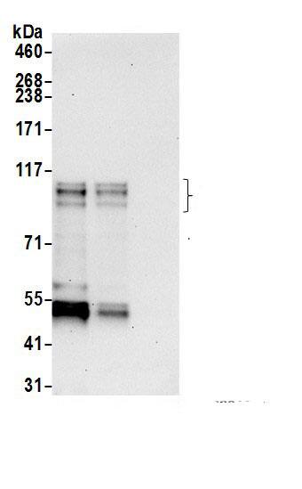 Immunoprecipitation:ARHGAP4 AntibodyNBP3-29658] -Detection of human ARHGAP4 by western blot of immunoprecipitates. Samples: Whole cell lysate (0.5 or 1.0 mg per IP reaction; 20% of IP loaded) from Jurkat cells prepared using NETN lysis buffer. Antibodies: Affinity purified rabbit anti-ARHGAP4 antibody NBP3-29658 (lot NBP3-29658-1) used for IP at 6 µg per reaction. ARHGAP4 was also immunoprecipitated by rabbit anti-ARHGAP4.. For blotting immunoprecipitated ARHGAP4, NBP3-29658 was used at 0.4 µg/ml. Detection: Chemiluminescence with an exposure time of 30 seconds.