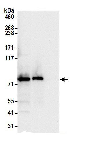 Immunoprecipitation:Aconitase 2 AntibodyNBP3-29659] -Detection of human ACO2 by western blot of immunoprecipitates. Samples: Whole cell lysate (0.5 or 1.0 mg per IP reaction; 20% of IP loaded) from 293T cells prepared using NETN lysis buffer. Antibodies: Affinity purified rabbit anti-ACO2 antibody NBP3-29659 (lot NBP3-29659-1) used for IP at 6 µg per reaction. ACO2 was also immunoprecipitated by rabbit anti-ACO2.. For blotting immunoprecipitated ACO2, NBP3-29659 was used at 1 µg/ml. Detection: Chemiluminescence with an exposure time of 3 seconds.