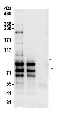 Immunoprecipitation:SPG20 AntibodyNBP3-29660] -Detection of human SPG20 by western blot of immunoprecipitates. Samples: Whole cell lysate (0.5 or 1.0 mg per IP reaction; 20% of IP loaded) from HeLa cells prepared using NETN lysis buffer. Antibodies: Affinity purified rabbit anti-SPG20 antibody NBP3-29660 (lot NBP3-29660-1) used for IP at 6 µg per reaction. SPG20 was also immunoprecipitated by rabbit anti-SPG20.. For blotting immunoprecipitated SPG20, NBP3-29660 was used at 1 µg/ml. Detection: Chemiluminescence with an exposure time of 10 seconds.