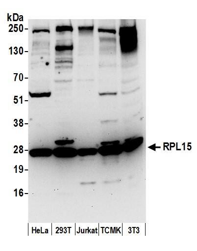 Western Blot:[NBP3-29661]-Detection of human and mouse RPL15 by western blot. Samples: Whole cell lysate from HeLa, HEK293T, Jurkat, mouse TCMK-1, and mouse NIH 3T3 cells prepared using NETN lysis buffer. Antibody: Affinity purified rabbit anti-RPL15 antibody used for WB at 0. 1 µg/ml. Detection: Chemiluminescence with an exposure time of 30 seconds.