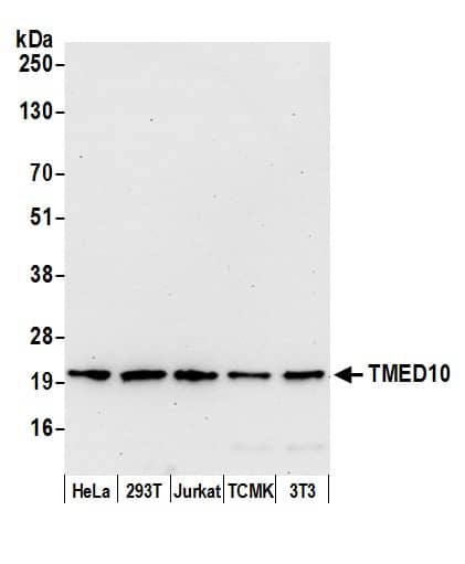 Western Blot:[NBP3-29664]-Detection of human and mouse TMED10 by western blot. Samples: Whole cell lysate from HeLa, HEK293T, Jurkat, mouse TCMK-1, and mouse NIH 3T3 cells prepared using NETN lysis buffer. Antibody: Affinity purified rabbit anti-TMED10 antibody used for WB at 0. 1 µg/ml. Detection: Chemiluminescence with an exposure time of 30 seconds.