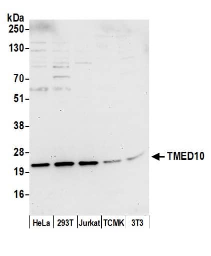 Western Blot:[NBP3-29665]-Detection of human and mouse TMED10 by western blot. Samples: Whole cell lysate from HeLa, HEK293T, Jurkat, mouse TCMK-1, and mouse NIH 3T3 cells prepared using NETN lysis buffer. Antibody: Affinity purified rabbit anti-TMED10 antibody used for WB at 0. 1 µg/ml. Detection: Chemiluminescence with an exposure time of 30 seconds.