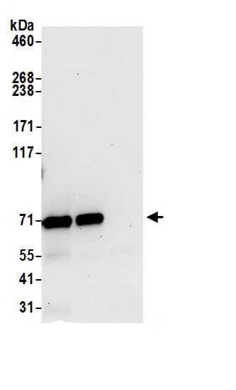 Immunoprecipitation:PGM2 AntibodyNBP3-29668] -Detection of human PGM2 by western blot of immunoprecipitates. Samples: Whole cell lysate (0.5 or 1.0 mg per IP reaction; 20% of IP loaded) from HeLa cells prepared using NETN lysis buffer. Antibodies: Affinity purified rabbit anti-PGM2 antibody NBP3-29668 (lot NBP3-29668-1) used for IP at 6 µg per reaction. PGM2 was also immunoprecipitated by rabbit anti-PGM2 antibody BL21985. For blotting immunoprecipitated PGM2, NBP3-29668 was used at 0.4 µg/ml. Detection: Chemiluminescence with an exposure time of 30 seconds.