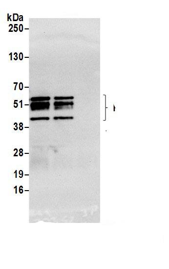 Immunoprecipitation:PRRC1 AntibodyNBP3-29669] -Detection of human PRRC1 by western blot of immunoprecipitates. Samples: Whole cell lysate (1.0 mg per IP reaction; 20% of IP loaded) from HeLa cells prepared using NETN lysis buffer. Antibodies: Affinity purified rabbit anti-PRRC1 antibody (NBP3-29669 lot 1) used for IP at 2 µg per reaction. PRRC1 was also immunoprecipitated by rabbit anti-PRRC1.. For blotting immunoprecipitated PRRC1, NBP3-29669 was used at 0.1 mg/ml. Detection: Chemiluminescence with an exposure time of 10 seconds.