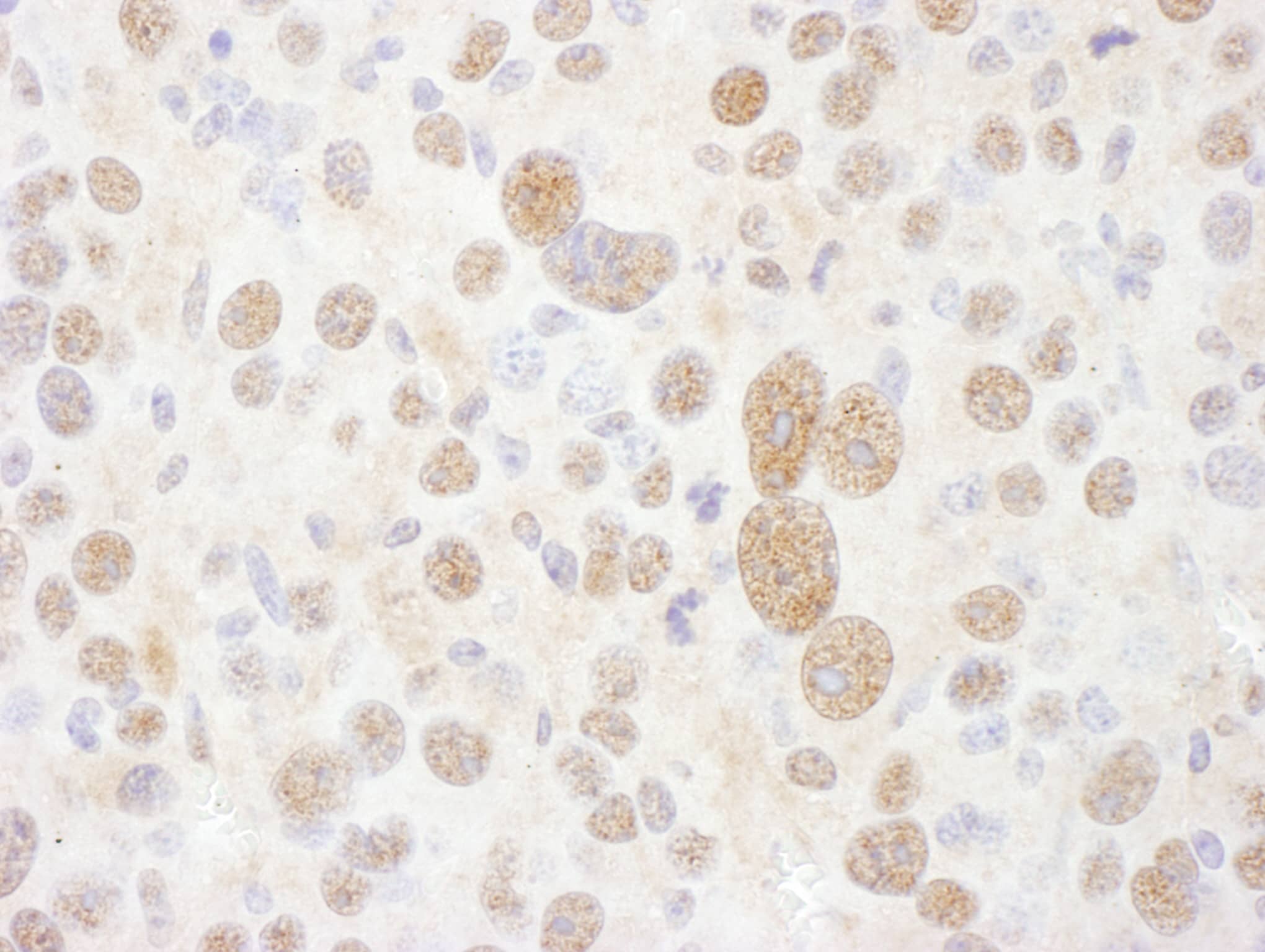 Immunohistochemistry;Proteasome 19S S7 Antibody[NBP3-29671]Detection of mouse PSMC2 by immunohistochemistry. Sample: FFPE section of mouse renal cell carcinoma. Antibody: Affinity purified rabbit anti-PSMC2  used at a dilution of 1:1,000 . Detection: DAB