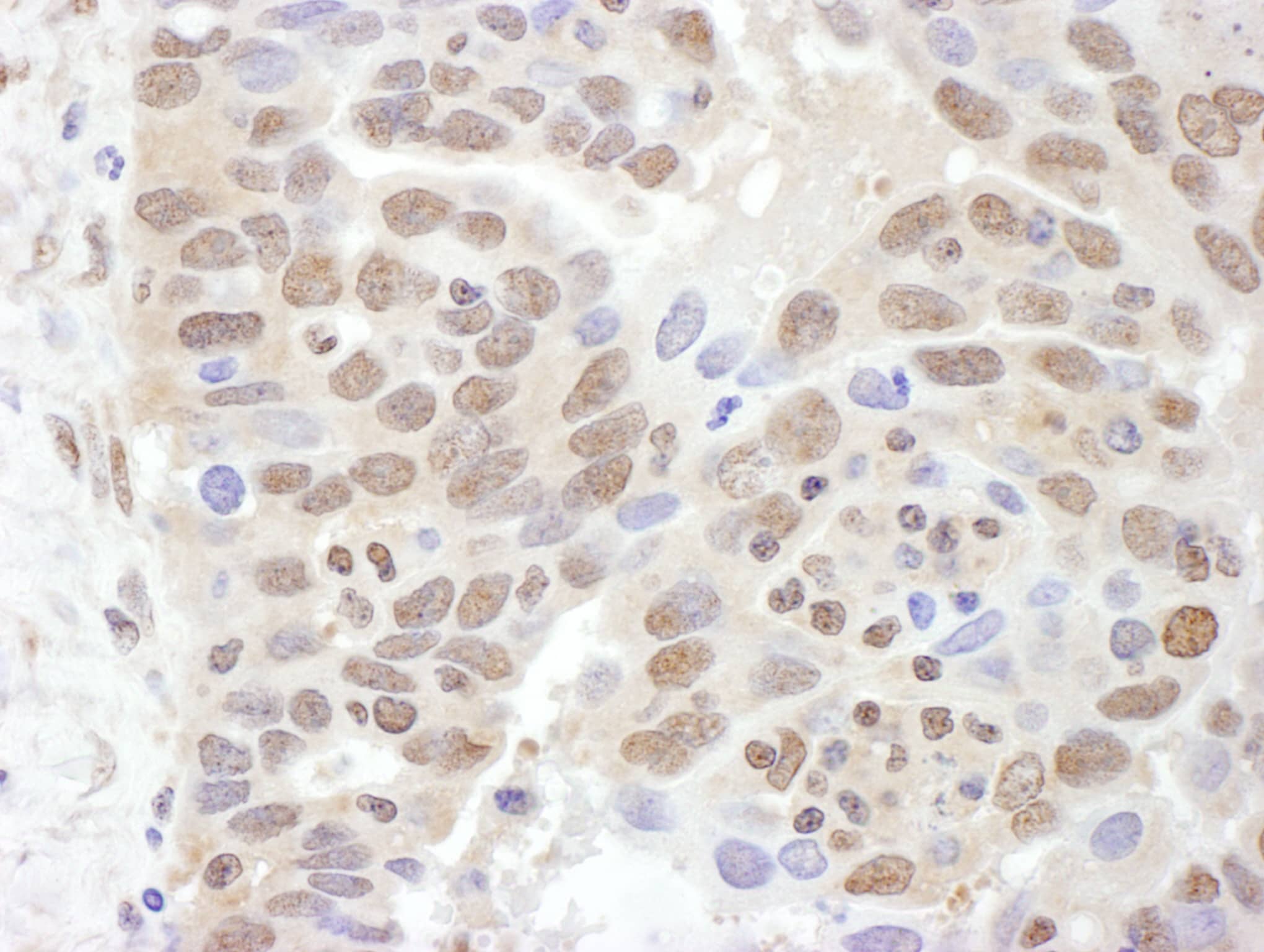 Immunohistochemistry Proteasome 19S S7 Antibody