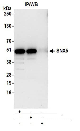 Immunoprecipitation:[NBP3-29673]-Detection of human SNX5 by western blot of immunoprecipitates. Samples: Whole cell lysate from 293T cells prepared using NETN lysis buffer. Antibodies: Affinity purified rabbit anti-SNX5 antibody used for IP at 6 µg per reaction. SNX5 was also immunoprecipitated by rabbit anti-SNX5 antibody. For blotting immunoprecipitated SNX5, was used at 1 µg/ml. Detection: Chemiluminescence with an exposure time of 10 seconds.