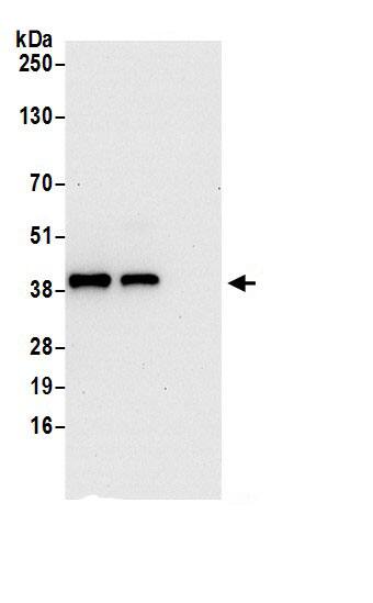 Immunoprecipitation:PDCL AntibodyNBP3-29674] -Detection of human PDCL by western blot of immunoprecipitates. Samples: Whole cell lysate (0.5 or 1.0 mg per IP reaction; 20% of IP loaded) from HeLa cells prepared using NETN lysis buffer. Antibodies: Affinity purified rabbit anti-PDCL antibody NBP3-29674 (lot NBP3-29674-1) used for IP at 6 µg per reaction. PDCL was also immunoprecipitated by rabbit anti-PDCL antibody BL21809. For blotting immunoprecipitated PDCL, NBP3-29674 was used at 1 µg/ml. Detection: Chemiluminescence with an exposure time of 30 seconds.