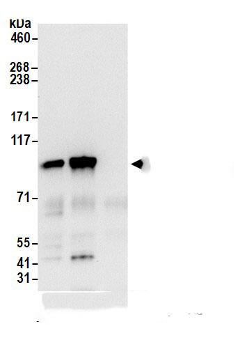 Immunoprecipitation:alpha Adaptin AntibodyNBP3-29676] -Detection of human Alpha-adaptin by western blot of immunoprecipitates. Samples: Whole cell lysate (0.5 or 1.0 mg per IP reaction; 20% of IP loaded) from 293T cells prepared using NETN lysis buffer. Antibodies: Affinity purified rabbit anti-Alpha-adaptin antibody NBP3-29676 (lot NBP3-29676-1) used for IP at 6 µg per reaction. Alpha-adaptin was also immunoprecipitated by rabbit anti-Alpha-adaptin antibody for blotting immunoprecipitated Alpha-adaptin, NBP3-29676 was used at 0.1 µg/ml. Detection: Chemiluminescence with an exposure time of 10 seconds.