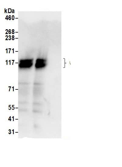 Immunoprecipitation:Calpastatin AntibodyNBP3-29677] -Detection of human Calpastatin/CAST by western blot of immunoprecipitates. Samples: Whole cell lysate (0.5 or 1.0 mg per IP reaction; 20% of IP loaded) from 293T cells prepared using NETN lysis buffer. Antibodies: Affinity purified rabbit anti-Calpastatin/CAST antibody NBP3-29677 (lot NBP3-29677-1) used for IP at 6 µg per reaction. Calpastatin/CAST was also immunoprecipitated by rabbit anti-Calpastatin/CAST.. For blotting immunoprecipitated Calpastatin/CAST, A304-794A was used at 1 µg/ml. Detection: Chemiluminescence with an exposure time of 3 seconds.