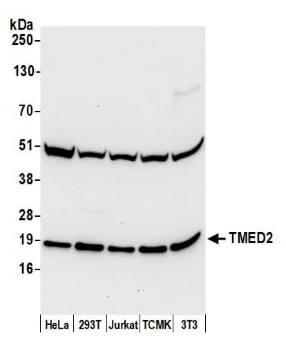 Western Blot:[NBP3-29679]-Detection of human and mouse TMED2 by western blot. Samples: Whole cell lysate from HeLa, HEK293T, Jurkat, mouse TCMK-1, and mouse NIH 3T3 cells prepared using NETN lysis buffer. Antibody: Affinity purified rabbit anti-TMED2 antibody used for WB at 0. 4 µg/ml. Detection: Chemiluminescence with an exposure time of 10 seconds.