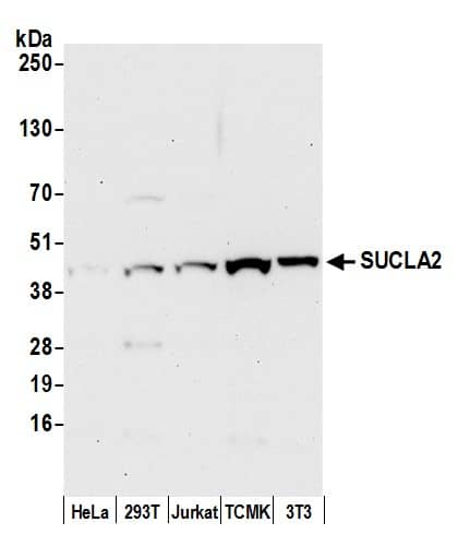 Western Blot:[NBP3-29680]-Detection of human and mouse SUCLA2 by western blot. Samples: Whole cell lysate from HeLa, HEK293T, Jurkat, mouse TCMK-1, and mouse NIH 3T3 cells prepared using NETN lysis buffer. Antibody: Affinity purified rabbit anti-SUCLA2 antibody used for WB at 0. 1 µg/ml. Detection: Chemiluminescence with an exposure time of 30 seconds.