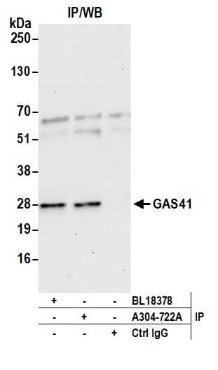 Immunoprecipitation:[NBP3-29682]-Detection of human GAS41 by western blot of immunoprecipitates. Samples: Whole cell lysate from 293T cells prepared using NETN lysis buffer. Antibodies: Affinity purified rabbit anti-GAS41 antibody used for IP at 6 µg per reaction. GAS41 was also immunoprecipitated by rabbit anti-GAS41 antibody. For blotting immunoprecipitated GAS41, was used at 1 µg/ml. Detection: Chemiluminescence with an exposure time of 30 seconds.