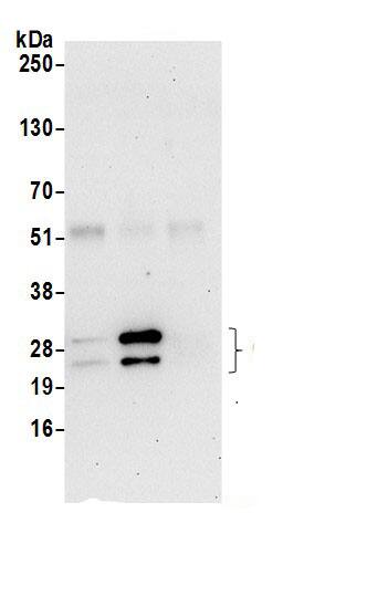 Immunoprecipitation:CHCHD3 AntibodyNBP3-29683] -Detection of human CHCHD3 by western blot of immunoprecipitates. Samples: Whole cell lysate (0.5 or 1.0 mg per IP reaction; 20% of IP loaded) from Jurkat cells prepared using NETN lysis buffer. Antibodies: Affinity purified rabbit anti-CHCHD3 antibody NBP3-29683 (lot NBP3-29683-1) used for IP at 6 µg per reaction. CHCHD3 was also immunoprecipitated by rabbit anti-CHCHD3 antibody BL21538. For blotting immunoprecipitated CHCHD3, NBP3-29683 was used at 1 µg/ml. Detection: Chemiluminescence with an exposure time of 30 seconds.