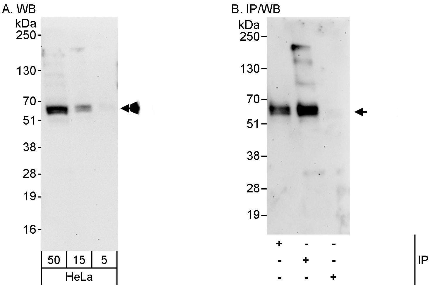 Western Blot:[NBP3-29685]-Detection of human ABI2 by western blot and immunoprecipitation. Samples: Whole cell lysate from HeLa cells. Antibodies: Affinity purified rabbit anti-ABI2 antibody used for WB at 0. 4 µg/ml and 1 µg/ml and used for IP at 3 µg/mg lysate. ABI2 was also immunoprecipitated by rabbit anti-ABI2 antibody BL9105, which recognizes an upstream epitope. Detection: Chemiluminescence with exposure times of 30 seconds and 3 minutes.