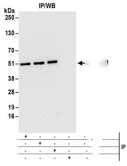 Immunoprecipitation:[NBP3-29687]-Detection of human DAZAP1 by western blot of immunoprecipitates. Samples: Whole cell lysate from HEK293T cells. Antibodies: Affinity purified rabbit anti-DAZAP1 antibody used for IP at 6 µg/mg lysate. DAZAP1 was also immunoprecipitated by rabbit anti-DAZAP1 antibodies and. For blotting immunoprecipitated DAZAP1, was used at 1 µg/ml. Detection: Chemiluminescence with an exposure time of 30 seconds.