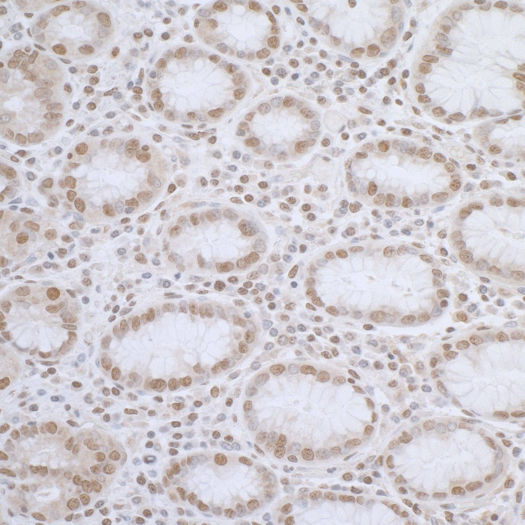 Immunohistochemistry;ELAC2 Antibody[NBP3-29672]Detection of human ELAC2 by immunohistochemistry. Sample: FFPE section of human stomach. Antibody: Affinity purified rabbit anti-ELAC2  used at a dilution of 1:1,000 . Detection: DAB