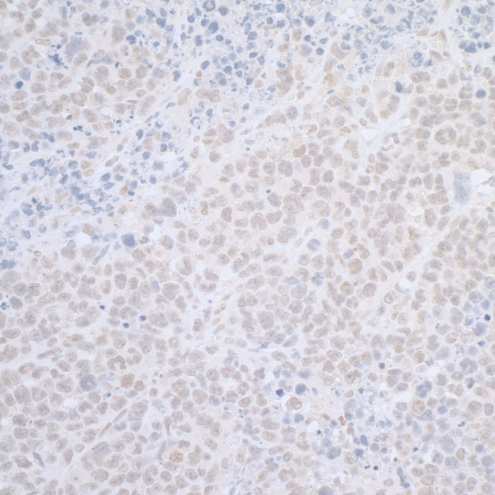 Immunohistochemistry;ELAC2 Antibody[NBP3-29688]Detection of mouse ELAC2 by immunohistochemistry. Sample: FFPE section of mouse plasmacytoma. Antibody: Affinity purified rabbit anti-ELAC2  used at a dilution of 1:1,000 . Detection: DAB