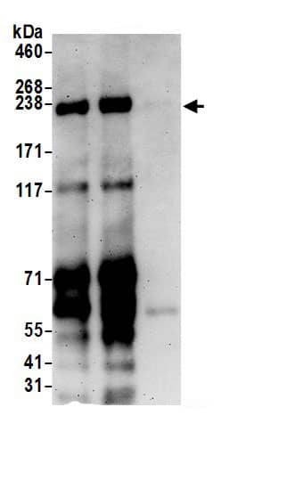 Immunoprecipitation:TRAP220/MED1 AntibodyNBP3-29690] -Detection of human MED1 by western blot of immunoprecipitates. Samples: Whole cell lysate (1.0 mg per IP reaction; 20% of IP loaded) from HEK293T cells prepared using NETN lysis buffer. Antibodies: Affinity purified goat anti-MED1 antibody NBP3-29690 (lot NBP3-29690-1) used for IP at 6 µg per reaction. MED1 was also immunoprecipitated by rabbit anti-MED1.. For blotting immunoprecipitated MED1, NBP3-29690 was used at 1 µg/ml. Detection: Chemiluminescence with an exposure time of 3 minutes.