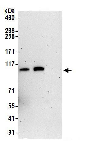 Immunoprecipitation:VPS18 AntibodyNBP3-29692] -Detection of human VPS18 by western blot of immunoprecipitates. Samples: Whole cell lysate (0.5 or 1.0 mg per IP reaction; 20% of IP loaded) from 293T cells prepared using NETN lysis buffer. Antibodies: Affinity purified rabbit anti-VPS18 antibody NBP3-29692 (lot NBP3-29692-1) used for IP at 6 µg per reaction. VPS18 was also immunoprecipitated by rabbit anti-VPS18 antibody. For blotting immunoprecipitated VPS18, NBP3-29692 was used at 1 µg/ml. Detection: Chemiluminescence with an exposure time of 3 minutes.