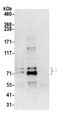 Immunoprecipitation:PALS1/MPP5 AntibodyNBP3-29694] -Detection of human MPP5 by western blot of immunoprecipitates. Samples: Whole cell lysate (0.5 or 1.0 mg per IP reaction; 20% of IP loaded) from 293T cells prepared using NETN lysis buffer. Antibodies: Affinity purified rabbit anti-MPP5 antibody NBP3-29694 (lot NBP3-29694-1) used for IP at 6 µg per reaction. MPP5 was also immunoprecipitated by rabbit anti-MPP5.. For blotting immunoprecipitated MPP5, NBP3-29694 was used at 1 µg/ml. Detection: Chemiluminescence with an exposure time of 30 seconds.