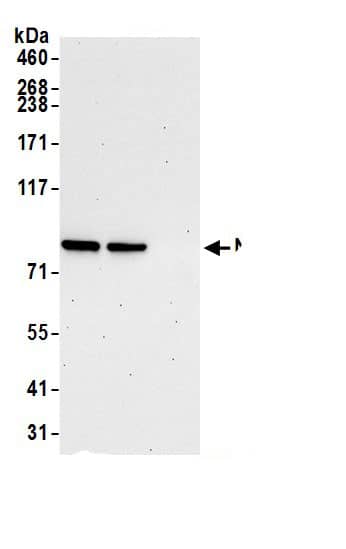 Immunoprecipitation:NUP93 AntibodyNBP3-29696] -Detection of human NUP93 by western blot of immunoprecipitates. Samples: Whole cell lysate (1.0 mg per IP reaction; 20% of IP loaded) from HEK293T cells prepared using NETN lysis buffer. Antibodies: Affinity purified rabbit anti-NUP93 antibody NBP3-29696 (lot NBP3-29696-2) used for IP at 3 µg per reaction. NUP93 was also immunoprecipitated by rabbit anti-NUP93 antibody BL14355. For blotting immunoprecipitated NUP93, NBP3-29696 was used at 1 µg/ml. Detection: Chemiluminescence with an exposure time of 30 seconds.