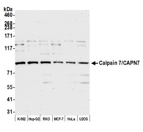 Western Blot:[NBP3-29697]-Detection of human Calpain 7/CAPN7 by western blot. Samples: Whole cell lysate from K-562, Hep-G2, RKO, MCF-7, HeLa, and U2OS cells prepared using NETN lysis buffer. Antibody: Affinity purified Rabbit anti-Calpain 7/CAPN7 antibody used for WB at 0. 04 mg/ml. Detection: Chemiluminescence with an exposure time of 75 seconds.