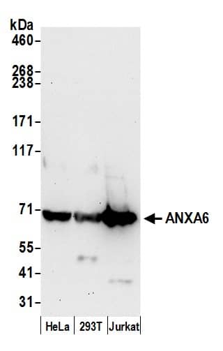 Western Blot:[NBP3-29699]-Detection of human ANXA6 by western blot. Samples: Whole cell lysate from HeLa, HEK293T, and Jurkat cells prepared using NETN lysis buffer. Antibody: Affinity purified rabbit anti-ANXA6 antibody used for WB at 0. 1 µg/ml. Detection: Chemiluminescence with an exposure time of 30 seconds.