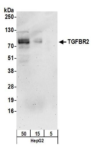 Western Blot:[NBP3-29702]-Detection of human TGFBR2 by western blot. Samples: Whole cell lysate prepared using NETN buffer from Hep-G2 cells. Antibodies: Affinity purified rabbit anti-TGFBR2 antibody used for WB at 1 µg/ml. Detection: Chemiluminescence with an exposure time of 3 minutes.