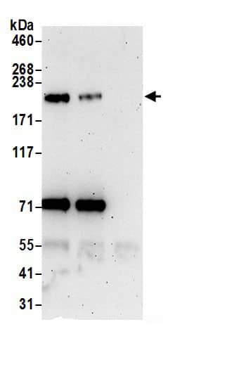 Immunoprecipitation:Integrin beta 4/CD104 AntibodyNBP3-29704] -Detection of human ITGB4 by western blot of immunoprecipitates. Samples: Whole cell lysate (0.5 or 1.0 mg per IP reaction; 20% of IP loaded) from HeLa cells prepared using NETN lysis buffer. Antibodies: Affinity purified rabbit anti-ITGB4 antibody NBP3-29704 (lot NBP3-29704-1) used for IP at 6 µg per reaction. ITGB4 was also immunoprecipitated by rabbit anti-ITGB4 antibody BL20628. For blotting immunoprecipitated ITGB4, NBP3-29704 was used at 0.4 µg/ml. Detection: Chemiluminescence with an exposure time of 3 minutes.