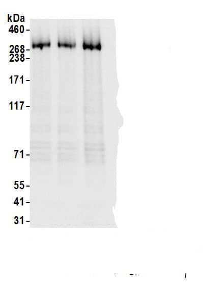 Immunoprecipitation:KAT4/TBP Associated Factor 1 AntibodyNBP3-29706] -Detection of human TAF1 by western blot of immunoprecipitates. Samples: Whole cell lysate (1.0 mg per IP reaction; 20% of IP loaded) from Jurkat cells prepared using NETN lysis buffer. Antibodies: Affinity purified rabbit anti-TAF1 antibody NBP3-29706 (lot NBP3-29706-2) used for IP at 6 µg per reaction. TAF1 was also immunoprecipitated by a previous lot of this antibody (lot NBP3-29706-1) and rabbit anti-TAF1.. For blotting immunoprecipitated TAF1, NBP3-29706 was used at 0.04 µg/ml. Detection: Chemiluminescence with an exposure time of 1 second.