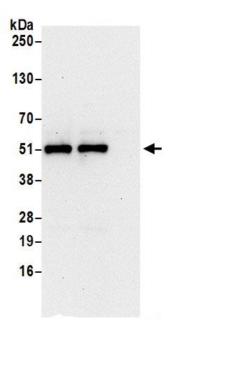 Immunoprecipitation:NOB1 AntibodyNBP3-29708] -Detection of human NOB1 by western blot of immunoprecipitates. Samples: Whole cell lysate (0.5 or 1.0 mg per IP reaction; 20% of IP loaded) from 293T cells prepared using NETN lysis buffer. Antibodies: Affinity purified rabbit anti-NOB1 antibody NBP3-29708 (lot NBP3-29708-1) used for IP at 6 µg per reaction. NOB1 was also immunoprecipitated by rabbit anti-NOB1 antibody BL18023. For blotting immunoprecipitated NOB1, NBP3-29708 was used at 0.4 µg/ml. Detection: Chemiluminescence with an exposure time of 30 seconds.