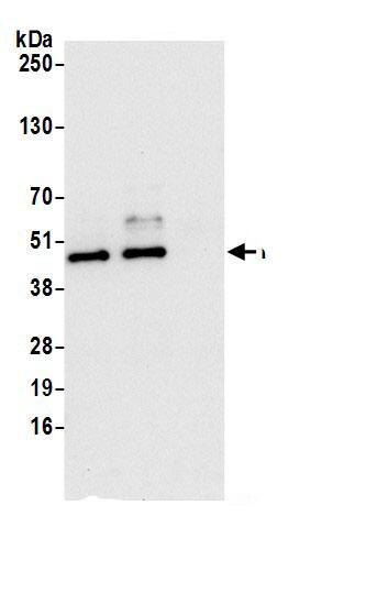 Immunoprecipitation:FDFT1 AntibodyNBP3-29709] -Detection of human FDFT1 by western blot of immunoprecipitates. Samples: Whole cell lysate (0.5 or 1.0 mg per IP reaction; 20% of IP loaded) from 293T cells prepared using NETN lysis buffer. Antibodies: Affinity purified rabbit anti-FDFT1 antibody NBP3-29709 (lot NBP3-29709-1) used for IP at 6 µg per reaction. FDFT1 was also immunoprecipitated by rabbit anti-FDFT1.. For blotting immunoprecipitated FDFT1, NBP3-29709 was used at 0.4 µg/ml. Detection: Chemiluminescence with an exposure time of 10 seconds.