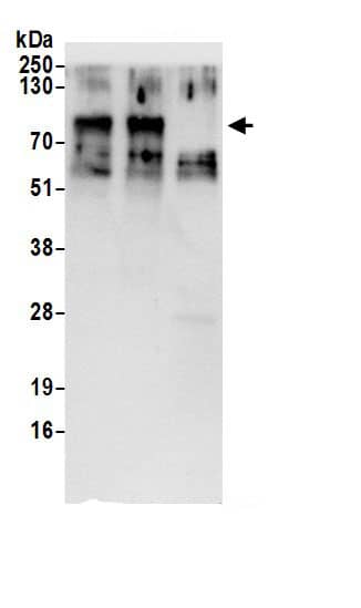 Immunoprecipitation:TGN38 AntibodyNBP3-29711] -Detection of human TGOLN2 by western blot of immunoprecipitates. Samples: Whole cell lysate (1 mg for IP; 20% of IP loaded) prepared using NETN buffer from 293T cells. Antibodies: Affinity purified rabbit anti-TGOLN2 antibody NBP3-29711 (lot NBP3-29711-1) used for IP at 6 µg per reaction. TGOLN2 was also immunoprecipitated by rabbit anti-TGOLN2.. For blotting immunoprecipitated TGOLN2, NBP3-29711 was used at 1 µg/ml. Detection: Chemiluminescence with an exposure time of 3 seconds.