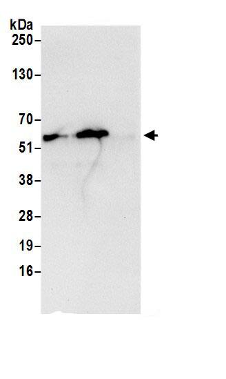 Immunoprecipitation:ATP5A AntibodyNBP3-29712] -Detection of human ATP5A1 by western blot of immunoprecipitates. Samples: Whole cell lysate (0.5 or 1.0 mg per IP reaction; 20% of IP loaded) from 293T cells prepared using NETN lysis buffer. Antibodies: Affinity purified rabbit anti-ATP5A1 antibody NBP3-29712 (lot NBP3-29712-1) used for IP at 6 µg per reaction. ATP5A1 was also immunoprecipitated by rabbit anti-ATP5A1.. For blotting immunoprecipitated ATP5A1, NBP3-29712 was used at 0.4 µg/ml. Detection: Chemiluminescence with an exposure time of 10 seconds.