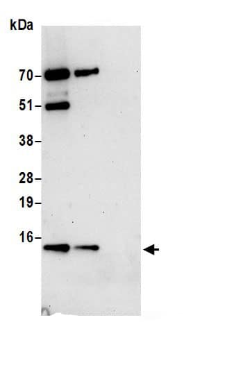 Immunoprecipitation:HIGD1A AntibodyNBP3-29713] -Detection of human HIGD1A by western blot of immunoprecipitates. Samples: Whole cell lysate (0.5 or 1.0 mg per IP reaction; 20% of IP loaded) from 293T cells prepared using NETN lysis buffer. Antibodies: Affinity purified rabbit anti-HIGD1A antibody NBP3-29713 (lot NBP3-29713-1) used for IP at 6 µg per reaction. HIGD1A was also immunoprecipitated by rabbit anti-HIGD1A antibody. For blotting immunoprecipitated HIGD1A, NBP3-29713 was used at 1 µg/ml. Detection: Chemiluminescence with an exposure time of 30 seconds.