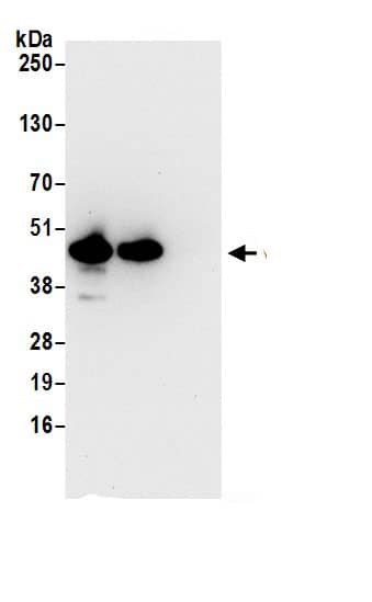 Immunoprecipitation:VAT1 AntibodyNBP3-29714] -Detection of human VAT1 by western blot of immunoprecipitates. Samples: Whole cell lysate (0.5 or 1.0 mg per IP reaction; 20% of IP loaded) from 293T cells prepared using NETN lysis buffer. Antibodies: Affinity purified rabbit anti-VAT1 antibody NBP3-29714 (lot NBP3-29714-1) used for IP at 6 µg per reaction. VAT1 was also immunoprecipitated by rabbit anti-VAT1.. For blotting immunoprecipitated VAT1, NBP3-29714 was used at 0.4 µg/ml. Detection: Chemiluminescence with an exposure time of 10 seconds.